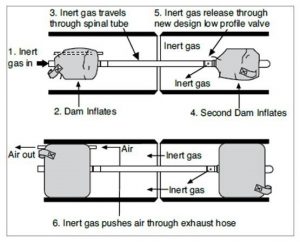 PurgElite Purging System